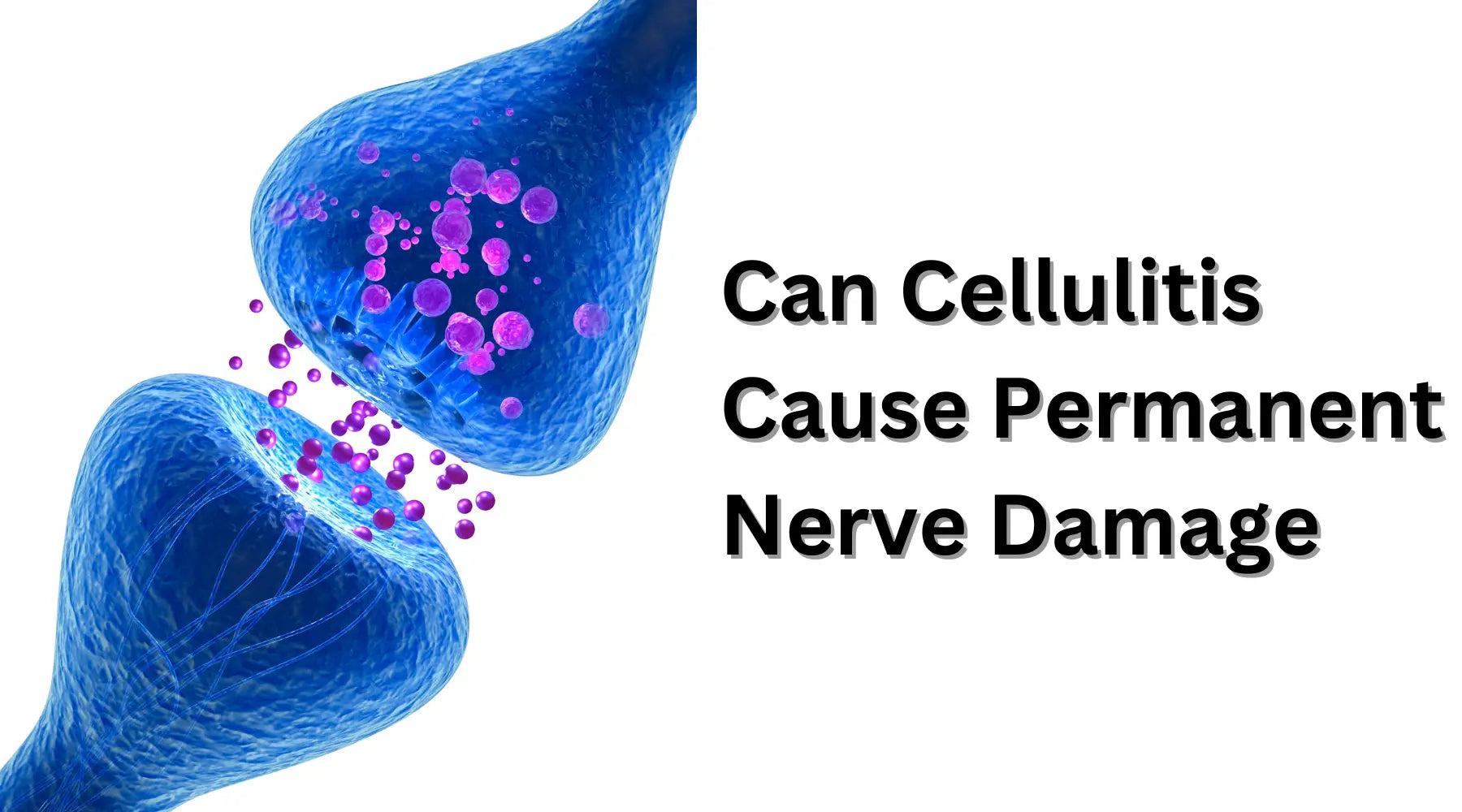 can-cellulitis-cause-permanent-nerve-damage-nature-s-blends